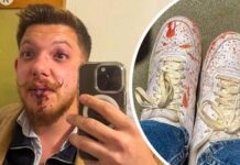 Secundul lui Sepsi, acuzat de agresiune la Sfântu Gheorghe scandal-imens-la-sfantu-gheorghe:-secundul-lui-sepsi,-acuzat-ca-l-a-luat-la-pumni!-de-la-ce-a-pornit-totul-+-dioszegi-ameninta-cu-masuri