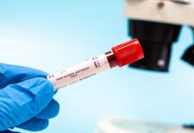 Lista țărilor afectate de hantavirus în 2026 și riscurile de infectare lista-actualizata-a-tarilor-afectate-de-hantavirus-in-2026.-unde-circula-cele-mai-periculoase-tulpini-si-ce-risc-de-infectare-exista