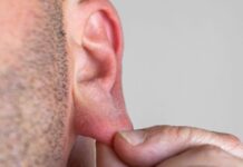 Lobul urechii, un detaliu ignorat, ar putea avea roluri surprinzătoare lobul-urechii-pare-inutil,-dar-ar-putea-avea-roluri-surprinzatoare.-micul-detaliu-al-corpului-pe-care-il-ignoram-cu-totii,-explicat-de-cercetatori